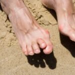 Recognizing Early Signs of Bunions: Prevention, Detection, and Treatment Options